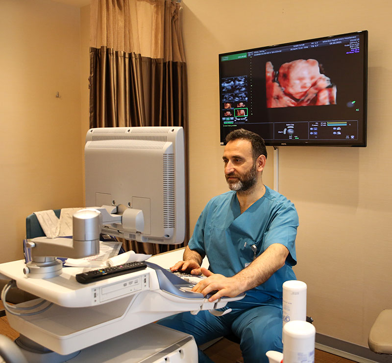 3D (3 Boyutlu) ve 4D (4 Boyutlu) Sonografi 3D (3 Boyutlu) ve 4D (4 Boyutlu) Sonografi