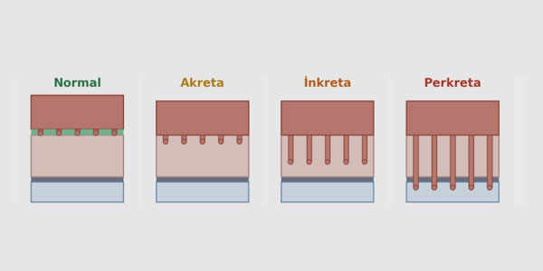 Plasenta ve Su Kesesi Sorunları Rehberi